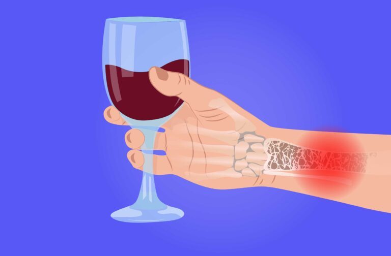 Does Alcohol Slow Bone Healing?