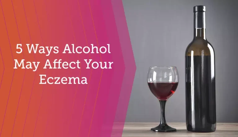 Does Alcohol Cause Eczema?