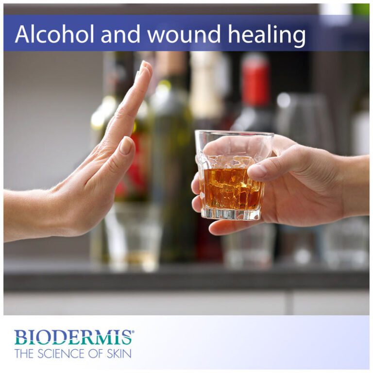 Does Alcohol Affect Healing?