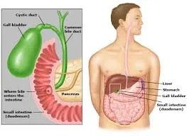 Does Alcohol Affect Gallstones?