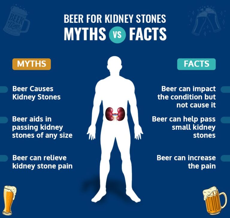 Can You Drink Alcohol If You Have Kidney Stones?